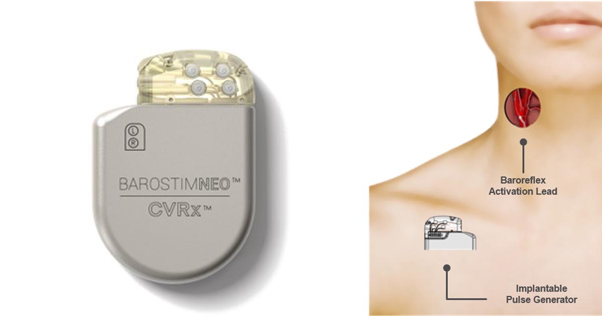 Clinical Trial for Heart Failure Patients Mercy